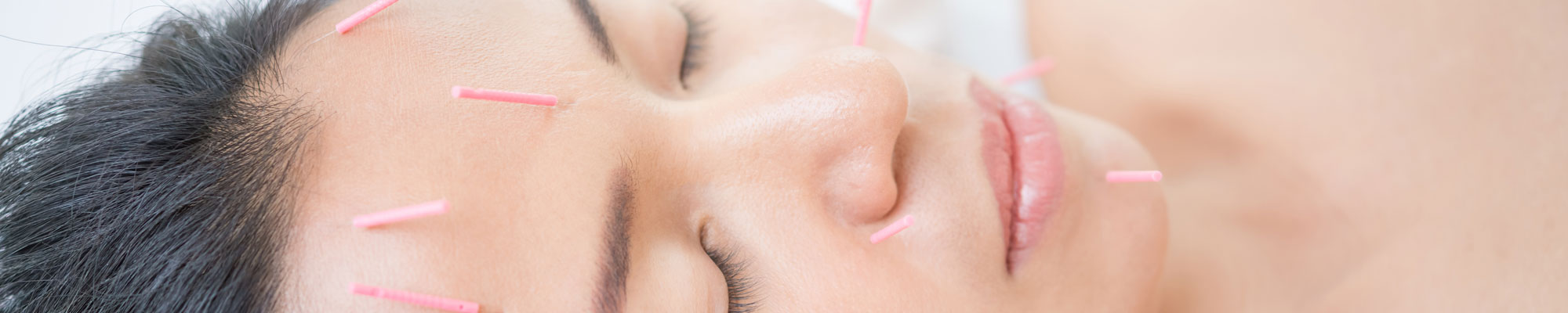 Woman having cosmetic acupuncture as part of training course