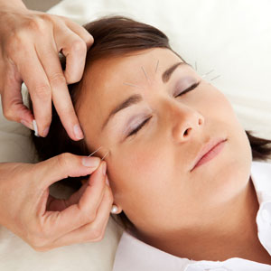 Woman having acupuncture around her eyes